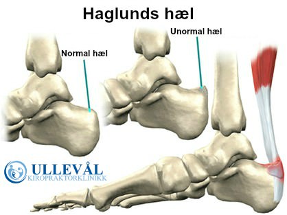 Haglunds hæl Ullevål Kiropraktorklinikk